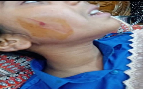 সীতাকুণ্ডে দিনে-দুপুরে স্কুলছাত্রীকে ছুরিকাঘাত করে দুল-চেইন ছিনতাই,  এক গৃহবধূকে অজ্ঞান করে লুট